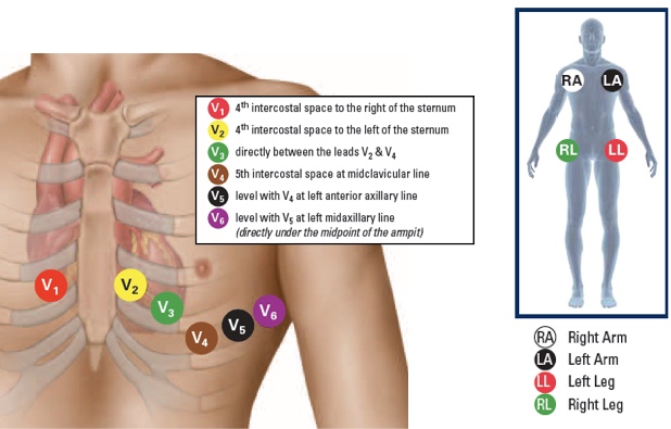 Using Mnemonics to Remember 12 Lead ECG Placement